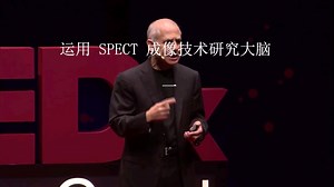 运用SPECT成像技术清晰获得你的脑健康状态