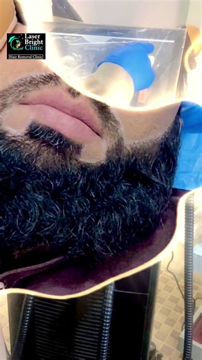 Special Discount on Professional Laser Hair Removal