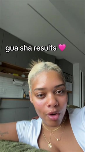 Gua Sha Results: Transformation in Minutes!