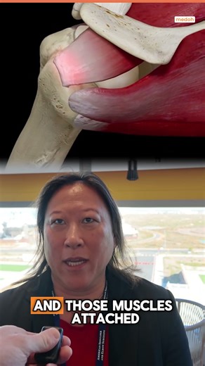 Rotator Cuff Tear Explained in 30 Seconds | Stephanie J Muh, MD (Michigan)
