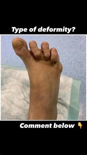 #PHYSIODOC on Instagram: "#Med #medical #post #posts #explore #page #pages #foryoupageofficial #viral #video #videos #video30detik #marketing #markeingdigital #digital #entrepreneurship #entrepreneur"