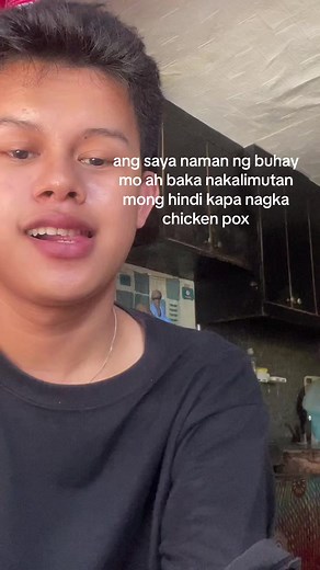 #charlieeslit | chicken pox early signs