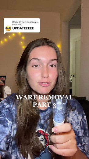 Replying to @Raw.sugaaaa WART UPDATE PART 3: 2nd application of the Compund Nitro Freeze - amazon link will be in the comments! I hope this little series has been helpful to you guys and i will continue trying to not only share my wart removal journy with you but also learn from you and hopefully make each other feel better about warts 🤍 #warts #wartremoval