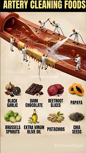TOP 8 Artery Cleaning Foods That Naturally Remove Plaque