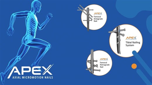 OrthoXel Micromotion Technology Animation