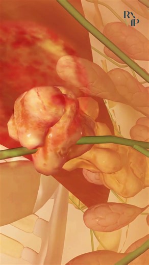 Not All Progesterone Is the Same