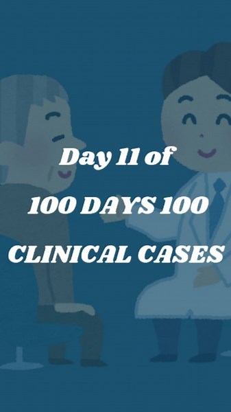 DR STRANGER 🩺 on Instagram: "🩺Day 11/100 of Diagnosing Clinical Cases Together 🩺 Watch the Finger-Nose Test in action! 👃🖐️ #MedicalEducation #Neurology #ClinicalSkills #PathologyQuiz. What pathology might a positive Finger-Nose Test indicate? 🤔"