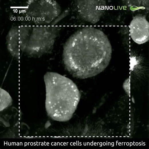 📣 𝗢𝗻𝗹𝗶𝗻𝗲 𝗗𝗲𝗺𝗼: 𝗥𝗲𝘁𝗵𝗶𝗻𝗸 𝗵𝗶𝗴𝗵-𝗰𝗼𝗻𝘁𝗲𝗻𝘁 𝘀𝗰𝗿𝗲𝗲𝗻𝗶𝗻𝗴 𝘄𝗼𝗿𝗸𝗳𝗹𝗼𝘄𝘀 𝗳𝗼𝗿 𝘀𝗺𝗮𝗿𝘁𝗲𝗿 𝗱𝗲𝗰𝗶𝘀𝗶𝗼𝗻𝘀