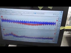 エアレーションとファインバブル（液循環）と超音波の最適化技術を開発－－共振現象と非線形現象の最適化技術－－（超音波システム研究所）