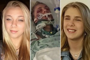 Woman who gouged out her EYES gets her first prosthetic eyeballs