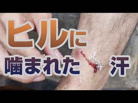 蛭（ヤマビル）に噛まれた〜っ！！ 対処方法 Leech countermeasure