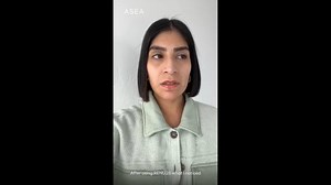 1.3K views · 24 reactions | Look what RENU28® Revitalizing Redox Gel has done for this happy customer as well as many others around the world! Get your confidence back with RENU28 Gel today! | ASEA | Facebook