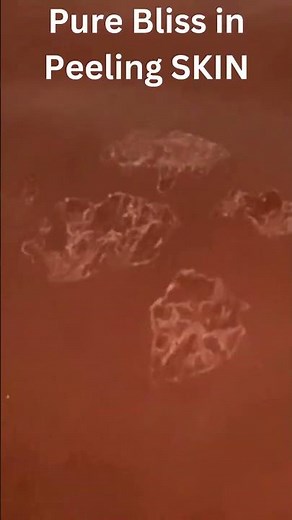 Picking and Scratching #relaxing #scratch #asmrtriggers #nails #scrath #asmrsounds #asmrvideos