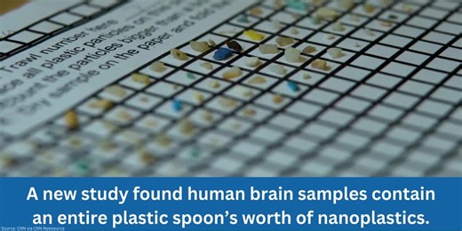 Human brains contain an entire spoon's worth of nanoplastics, study finds