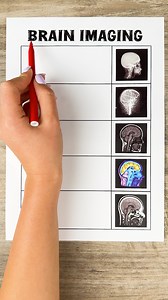 9.3K views · 18 reactions | What each brain scan sees 易 | Art & Civil engineering | Facebook