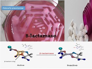 Beta Lactamases: Introduction, its types and various detection methods
