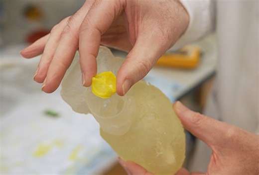 New Implant May Help Patients Regenerate Their Own Heart Valves