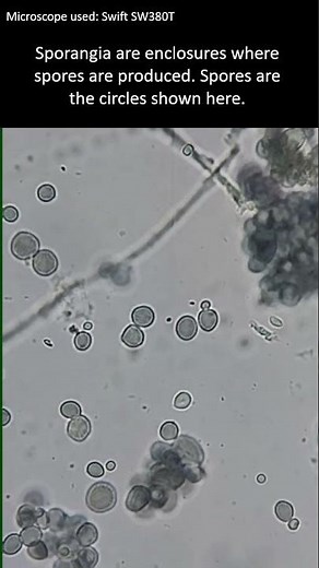 The mycelium and spores of mold under the microscope. #microscopy