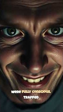 The "Smiling" Death of 1800s France