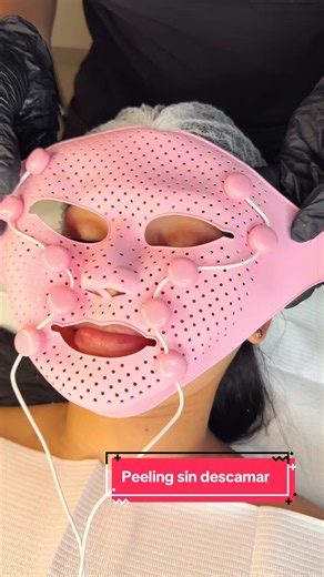Peeling Facial sin descamar✨ Esto incluye nuestro facial coreano con Dermaplaning Hidralips de Acido Hialuronico ESPERMA DE SALMÓN Incluye mascarilla para desintoxicar la piel, una mascarilla aclarante, dermaplaning para eliminar células muertas y todo el vello facial, mascarilla descongestiva e hidratante de piel con luz LED, crioterapia para iluminar nuestro rostro, y finalizamos con el dermapen con 4 tipos de ácido hialuronico para hidratar a intensidad nuestros FECTO DE PORCELANA labios 1. L