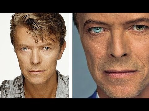 RAREST EYE COLORS In Humans