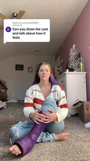 TikTok Broken Leg Cast Experience: A Personal Account