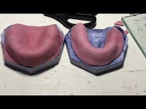 Elaboración de cucharillas individuales, rectificación de bordes con modelina y planchas bases
