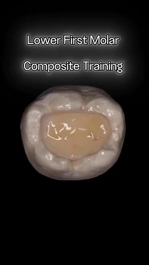 34K views · 358 reactions | #steb_by_steb_composite_training | Dentist Tareg T. Algahdari | Facebook