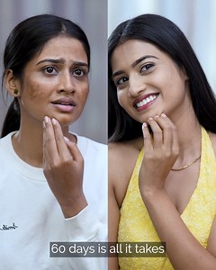 Over 10 Lakh Women Are Enjoying Customized Skincare With SkinKraft A FREE SkinID Quiz is all you need to fill out to get started for skincare that’s: 💙A set of 3 unique products 💙Made with 100% safe & effective ingredients 💙Recommended by India’s leading dermatologists Click the link below and get closer to the clear, soft, and glowing skin you’ve always wanted! 👇🏼 Take FREE SkinID quiz→ http://skraft.in/K6QNaDU Get Customized Skin Care→ http://skraft.in/K6QNaDU | SkinKraft