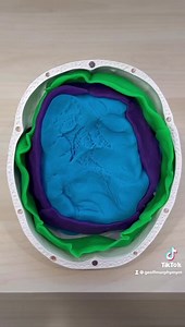 The difference between Subdural and Epidural Bleeds 🧠 Struggling in Paramedic School? We can help with that! 👉 courses.masteryourmedics.com #paramedic #paramediclife #paramedicschool #paramedicstudent #ems #emt #emtschool #emtstudent #nursing | Master Your Medics