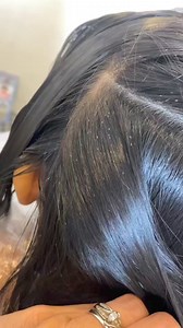 53K views · 318 reactions | Shop my lice removal and lice prevention products at www.RGVLiceLady.com #RGVLiceLady #lice #liceremoval #piojos #liceremovalservice #liceprevention | LRS - Lice Removal Service | Facebook