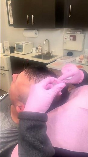 pDGF for hair growth #fyp