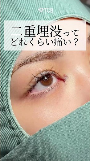 [Double Eyelid Surgery] How painful is double eyelid surgery using the suture method? #shorts