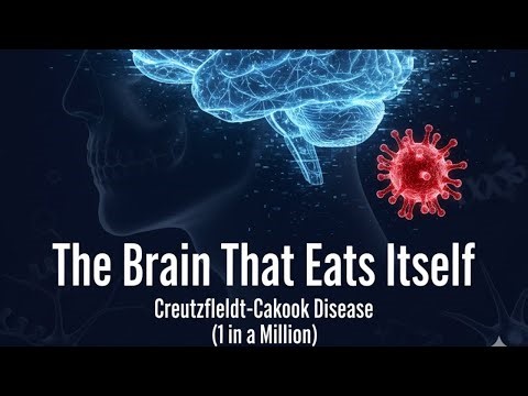 The Rare Brain Disease That Eats Itself: Creutzfeldt-Jakob Disease