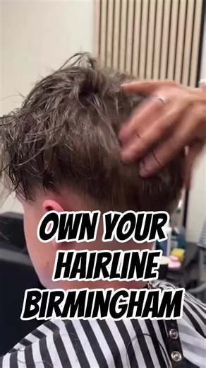 Achieve a Natural Look with Our Signature Hair System