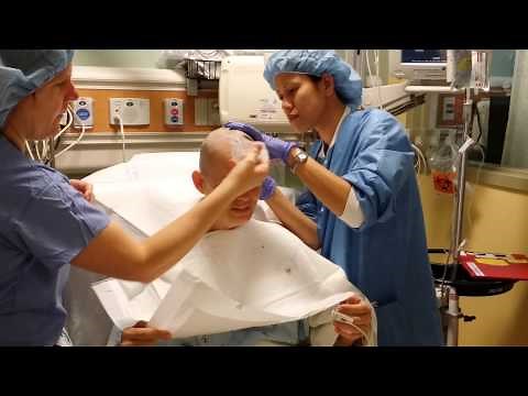Essential tremor, The head shave! #DBS surgery #bebrave
