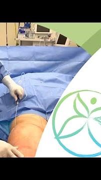 Lipedema Surgery Process - Lipedema Treatment NJ&NY - Dr. Boris Volshteyn
