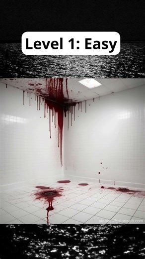 Phobia test (Hemophobia)Fear from blood