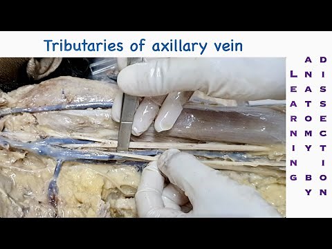 Dissection of axilla and tributaries of axillary vein | Dissection of upper limb | Dr. SAM