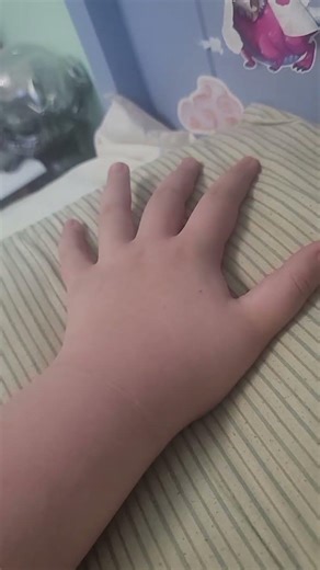 i think ppl can do it idk tho