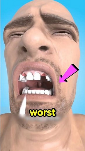 Why Throwing Away a Knocked-Out Tooth Could Ruin Your Smile Forever