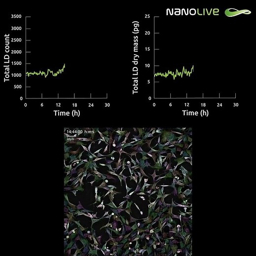 Quantifying lipid droplet dynamics, label-free