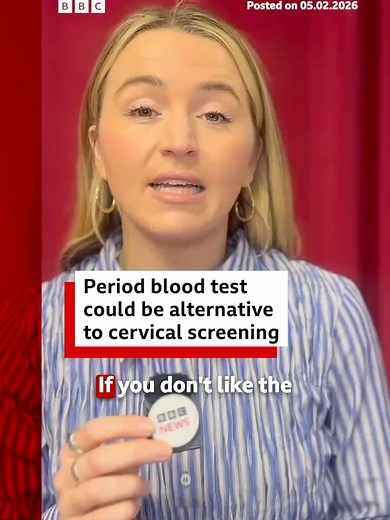 The current NHS test involves a nurse or doctor taking a sample of cells from the cervix - but a third of women invited for screening do not attend. #CervicalScreening #Period #SmearTest #News #BBCNews