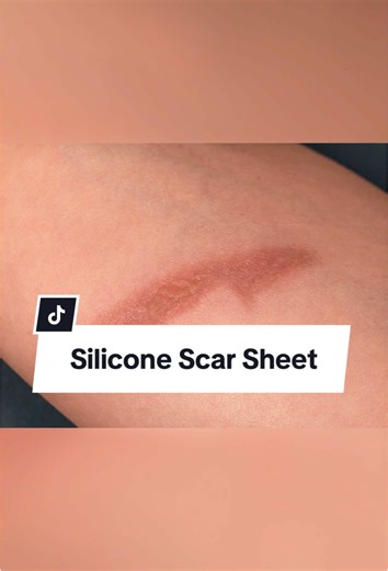 #scar #siliconesheet #skin #scarsheet #skinbarrier #eyehealth