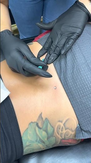 How to Insert Dermal Anchors: Step-by-Step Guide