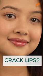 Are chapped lips stopping you from smiling wide? Don’t worry! Swipe away dryness and swipe on Himalaya Lip Balm for beautiful lips! #Himalaya #LipBalm | Himalaya Face Care Nepal
