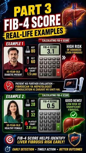 FIB-4 Score Real-Life Examples (Part 3) | High Risk vs Low Risk Explained