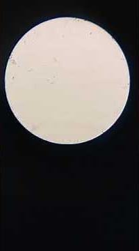 Live Sperm Under the Microscope – Amazing Footage!