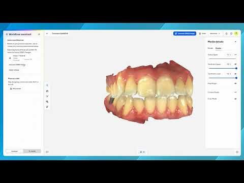 DS Core Plan Feature - CEREC on DS Core - User Interface