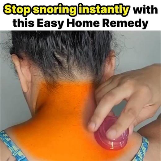 Think nose strips help with snoring? Think again.  Most men don’t know this but snoring has nothing to do with your nose, pillow placement, sleeping position or even weight… There is a hidden muscle that is responsible for 97% of snoring. Watch the video and find out how to control snoring in just one night  | Dream Better | Facebook